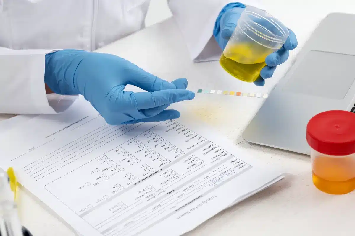 Building a Safer Workplace: The Essential Guide to Drug Testing for Australian Employers