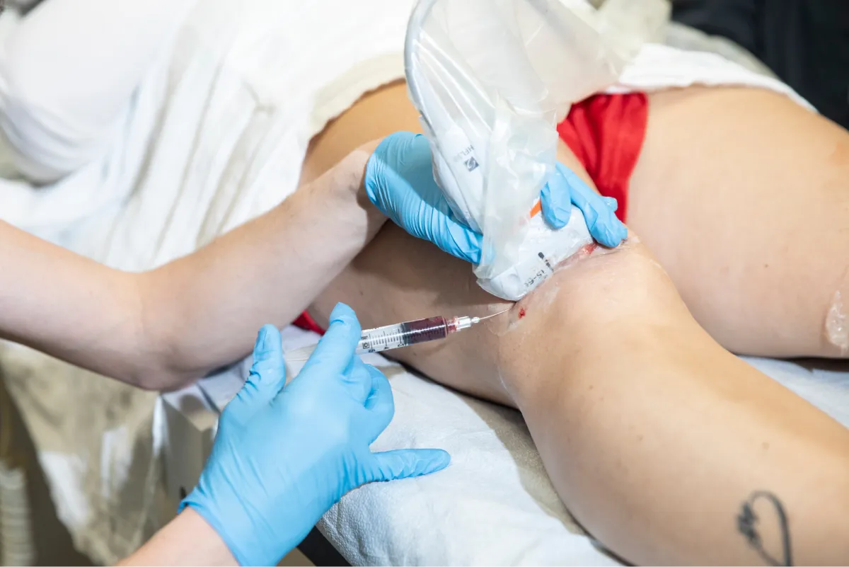 Lessening Intrinsic Painful Inflammation