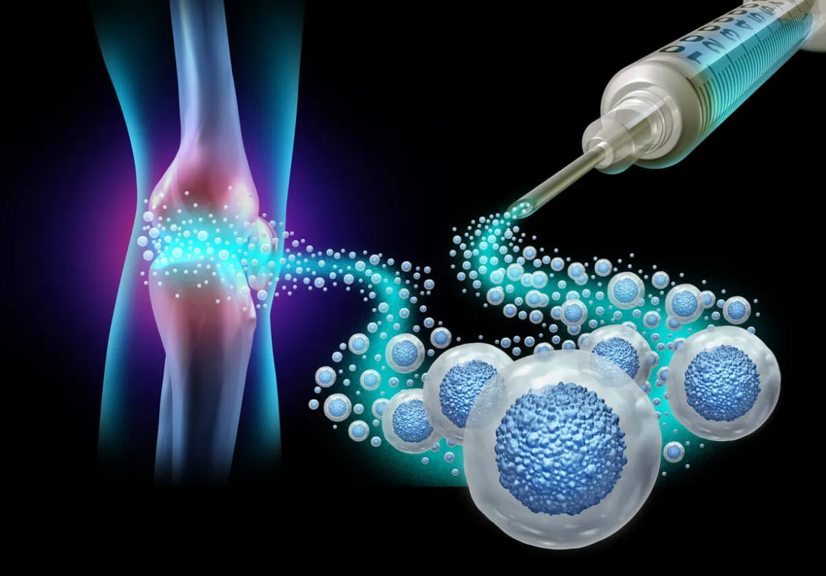 What Are Stem Cell Injections and How Do They Work